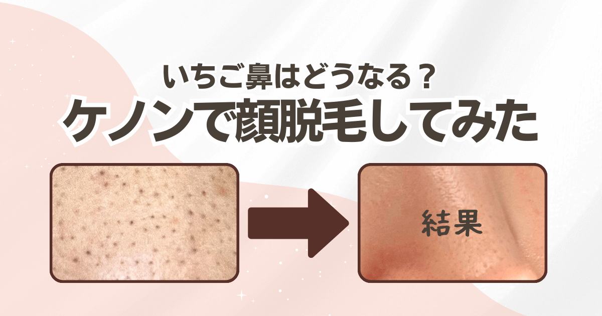 ケノンでいちご鼻はきれいになる?顔脱毛をしてみた結果…