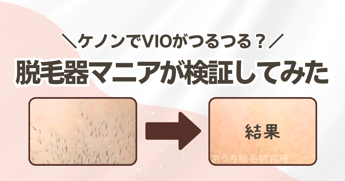 ケノンでVIOはツルツルになる?脱毛器マニアが検証してみた